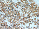 Desmin Antibody in Immunohistochemistry (Paraffin) (IHC (P))
