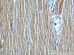 Desmin Antibody in Immunohistochemistry (Paraffin) (IHC (P))