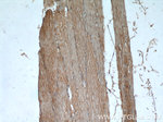 Desmin Antibody in Immunohistochemistry (Paraffin) (IHC (P))