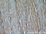 Desmin Antibody in Immunohistochemistry (Paraffin) (IHC (P))