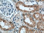 IFT88 Antibody in Immunohistochemistry (Paraffin) (IHC (P))
