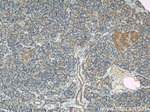 IFT88 Antibody in Immunohistochemistry (Paraffin) (IHC (P))
