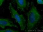 Cytoglobin Antibody in Immunocytochemistry (ICC/IF)