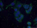 Cytoglobin Antibody in Immunocytochemistry (ICC/IF)