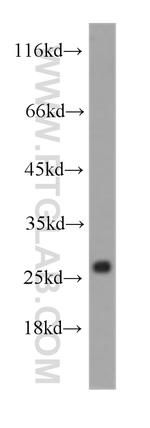 Cytoglobin Antibody in Western Blot (WB)