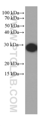 Cytoglobin Antibody in Western Blot (WB)