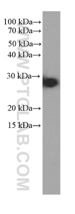 Cytoglobin Antibody in Western Blot (WB)