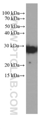 Cytoglobin Antibody in Western Blot (WB)