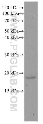 Myosin Light Chain 2 Antibody in Western Blot (WB)