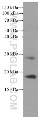 Myosin Light Chain 2 Antibody in Western Blot (WB)