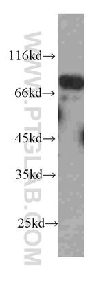 FAF1 Antibody in Western Blot (WB)