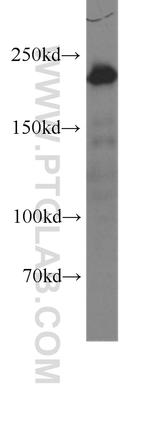 MYH9 Antibody in Western Blot (WB)