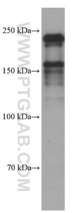 MYH9 Antibody in Western Blot (WB)
