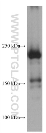 MYH9 Antibody in Western Blot (WB)