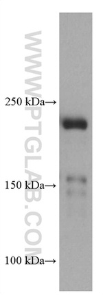MYH9 Antibody in Western Blot (WB)