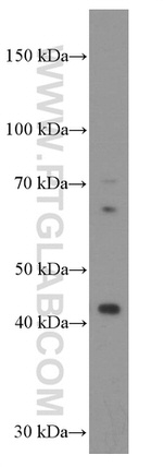 Gamma cystathionase Antibody in Western Blot (WB)