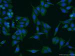 COTL1 Antibody in Immunocytochemistry (ICC/IF)