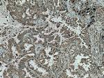 COTL1 Antibody in Immunohistochemistry (Paraffin) (IHC (P))