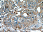COTL1 Antibody in Immunohistochemistry (Paraffin) (IHC (P))