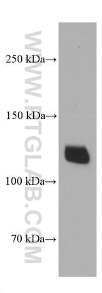 Desmocollin 2 Antibody in Western Blot (WB)