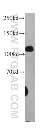 Desmocollin 2 Antibody in Western Blot (WB)