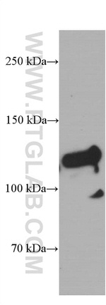 Desmocollin 2 Antibody in Western Blot (WB)