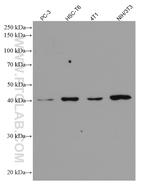 p504S/AMACR Antibody in Western Blot (WB)
