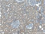 PLAA Antibody in Immunohistochemistry (Paraffin) (IHC (P))