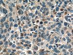 PGRMC2 Antibody in Immunohistochemistry (Paraffin) (IHC (P))