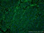 PGRMC2 Antibody in Immunohistochemistry (PFA fixed) (IHC (PFA))