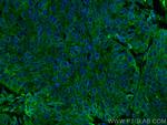 PGRMC2 Antibody in Immunohistochemistry (PFA fixed) (IHC (PFA))