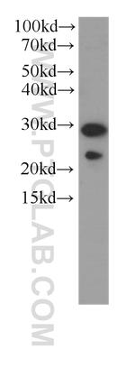 PGRMC2 Antibody in Western Blot (WB)