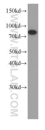 HADHA Antibody in Western Blot (WB)