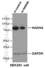HADHA Antibody in Western Blot (WB)