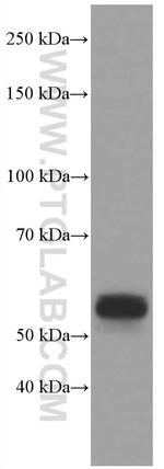 CD14 Antibody in Western Blot (WB)