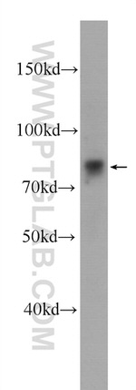 Zyxin Antibody in Western Blot (WB)