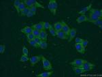 SMN-Exon7 Antibody in Immunocytochemistry (ICC/IF)
