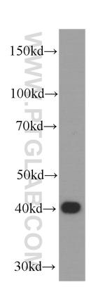 SMN-Exon7 Antibody in Western Blot (WB)