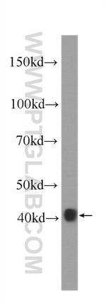 SMN-Exon7 Antibody in Western Blot (WB)