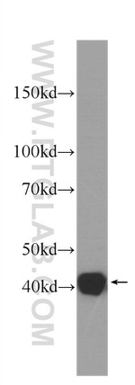 SMN-Exon7 Antibody in Western Blot (WB)
