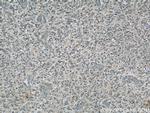 Dynamitin (1-401 AA) Antibody in Immunohistochemistry (Paraffin) (IHC (P))