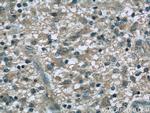 Dynamitin (1-401 AA) Antibody in Immunohistochemistry (Paraffin) (IHC (P))