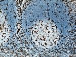 CD11c/Integrin alpha X Antibody in Immunohistochemistry (Paraffin) (IHC (P))