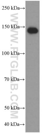 CD11c/Integrin alpha X Antibody in Western Blot (WB)