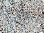 CD11c/Integrin alpha X Antibody in Immunohistochemistry (Paraffin) (IHC (P))