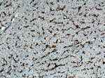 CD11c/Integrin alpha X Antibody in Immunohistochemistry (Paraffin) (IHC (P))