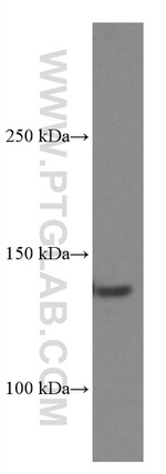 CD11c/Integrin alpha X Antibody in Western Blot (WB)