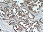 Napsin A Antibody in Immunohistochemistry (Paraffin) (IHC (P))