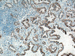 Napsin A Antibody in Immunohistochemistry (Paraffin) (IHC (P))