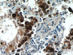 Napsin A Antibody in Immunohistochemistry (Paraffin) (IHC (P))